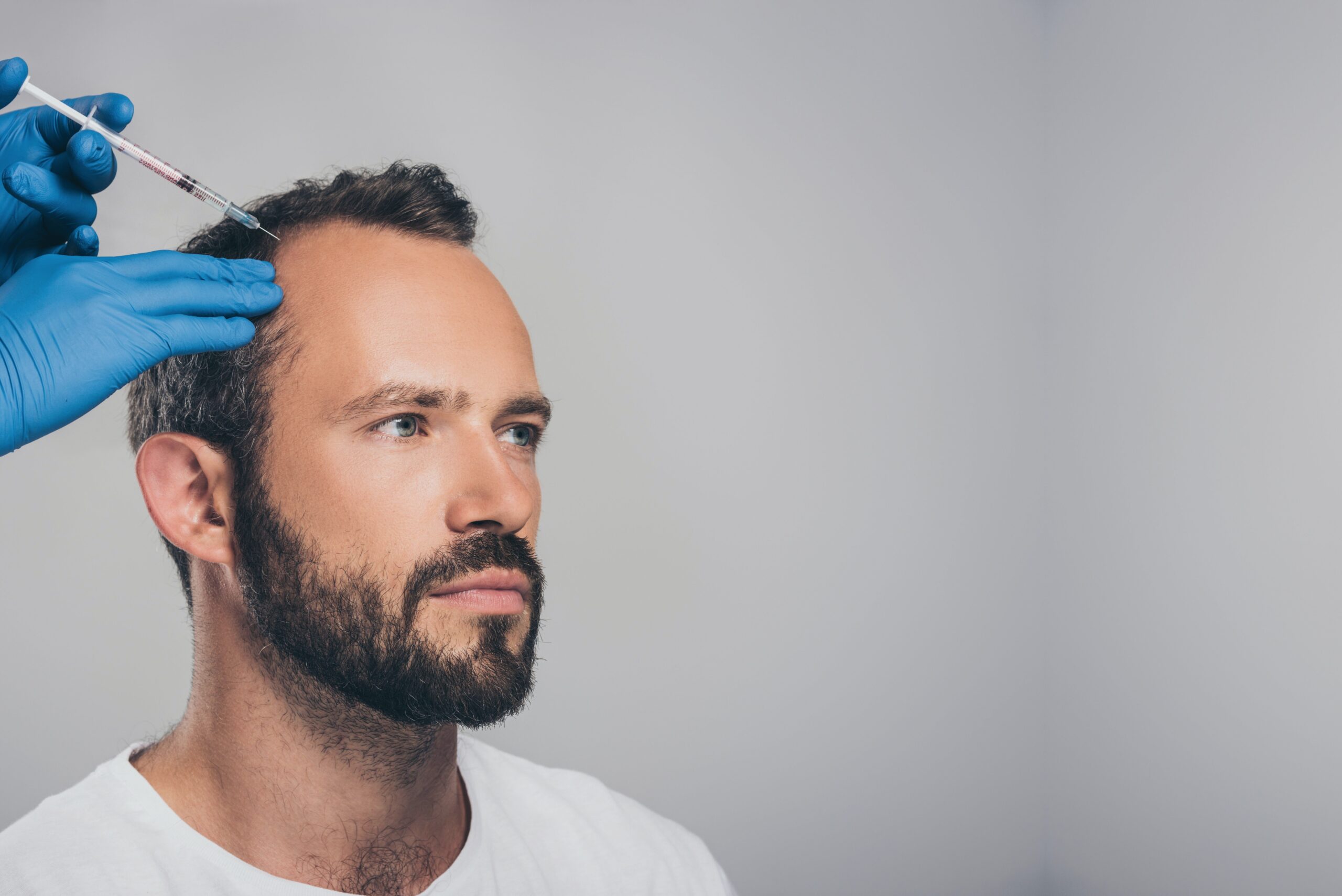 man with dark hair getting treatment on his hair