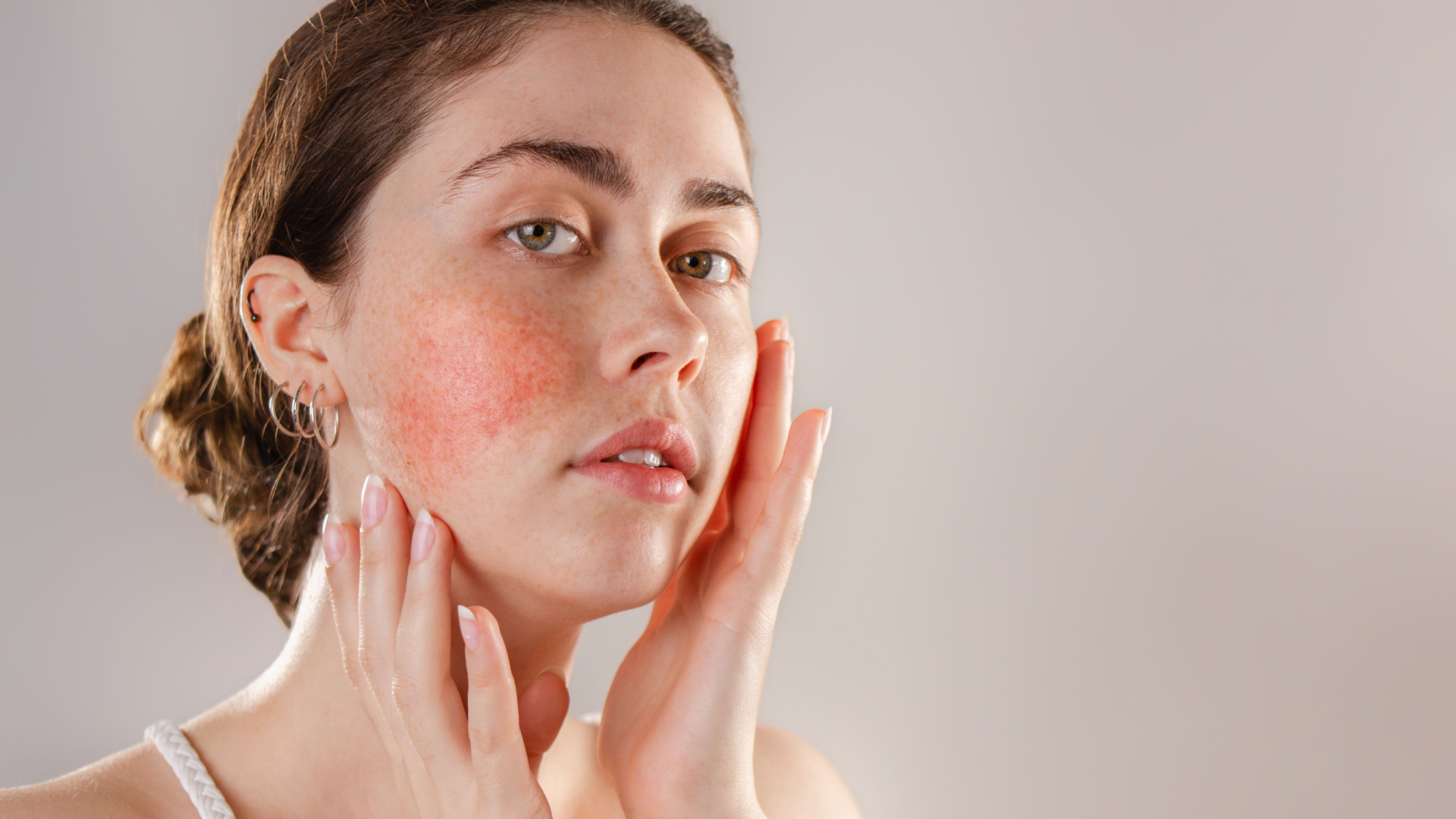 woman touching her red face