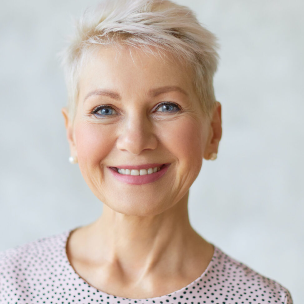 older woman after restylane