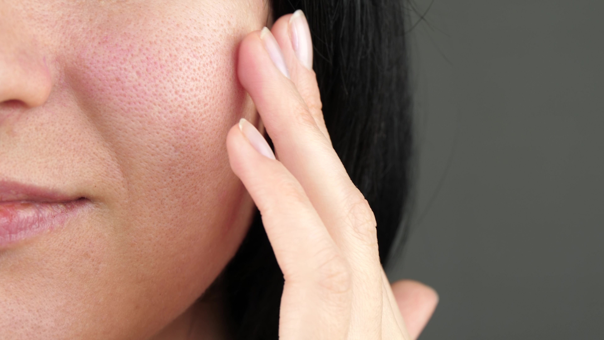 woman with enlarged pores