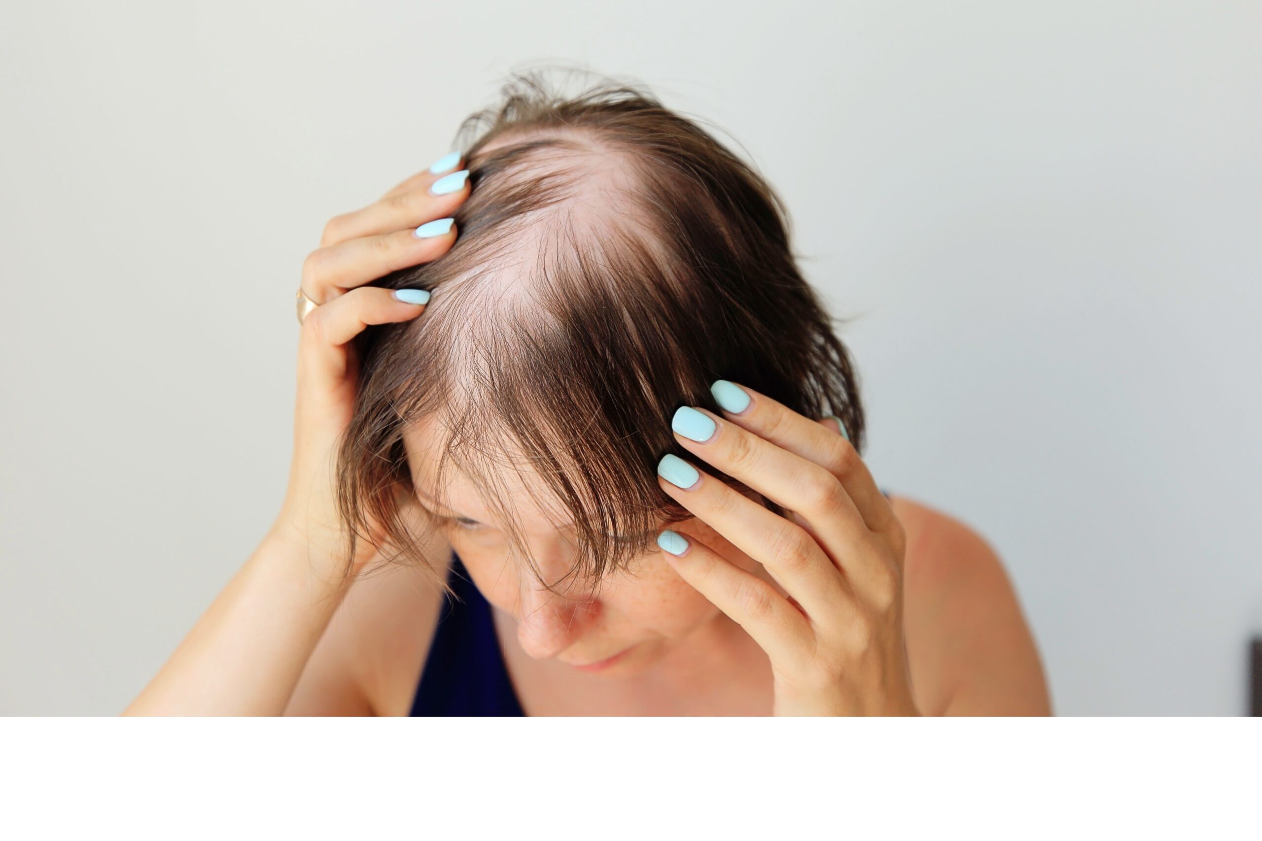 Woman with bald spot