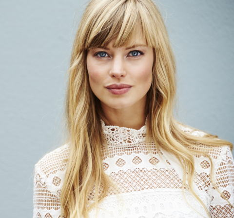 woman with dermal fillers.