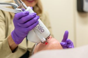 Woman Receiving Halo Laser Treatment