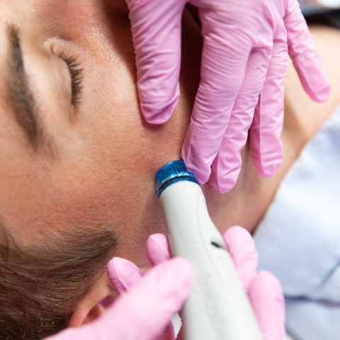man getting HydraFacial by doctor