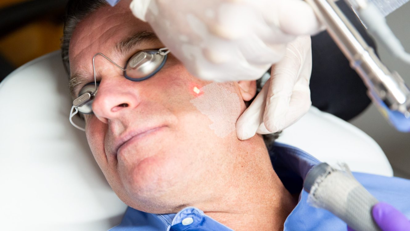 a man receives laser skin resurfacing treatment near minneapolis