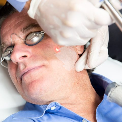 a man receives laser skin resurfacing treatment near minneapolis