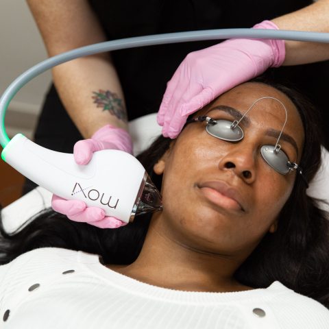 Woman getting laser surgery done