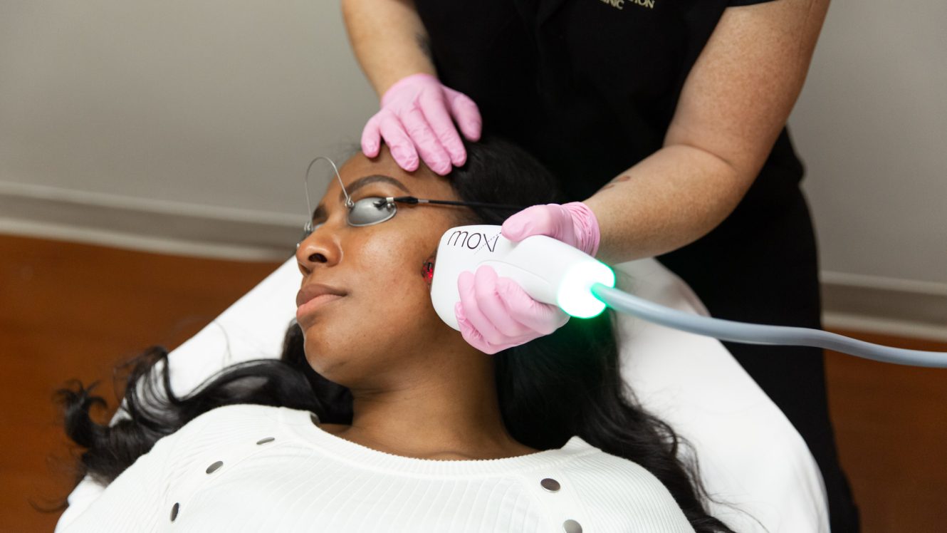 Woman receiving Moxi Laser treatment