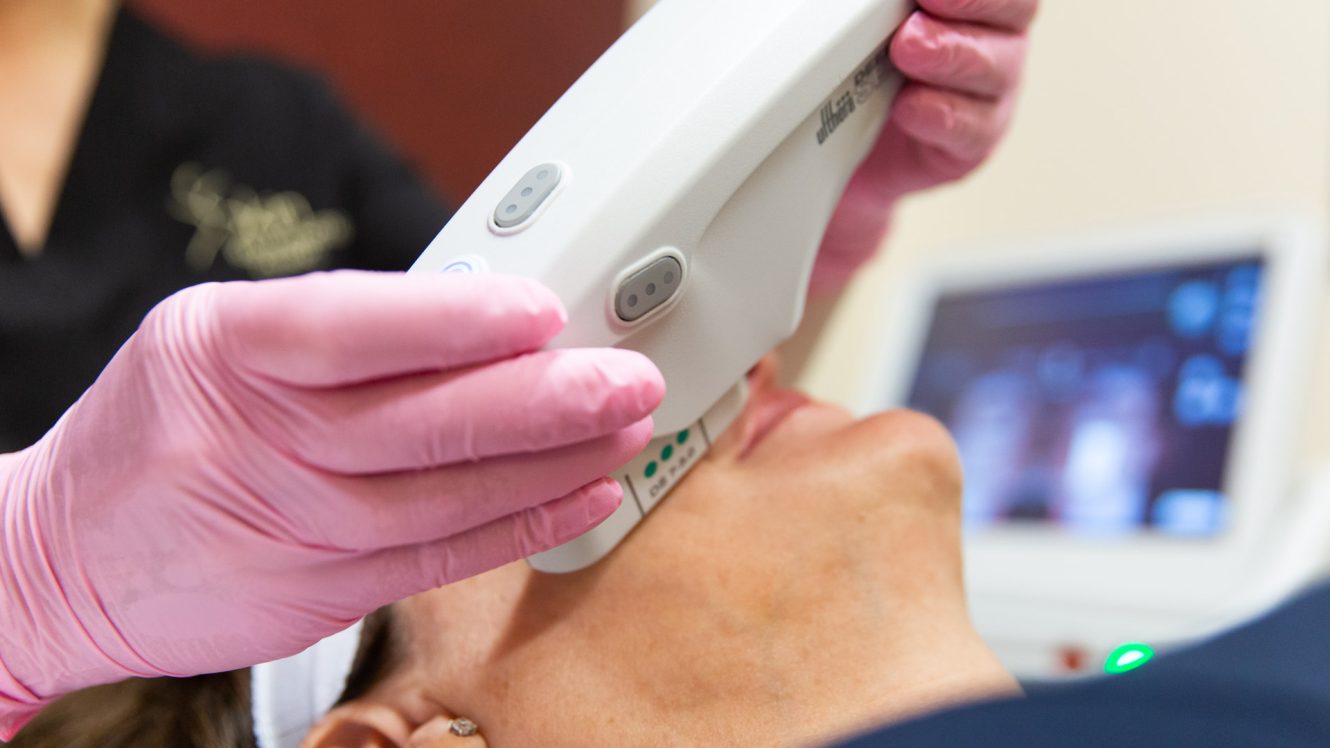 Woman receiving Ultherapy treatment