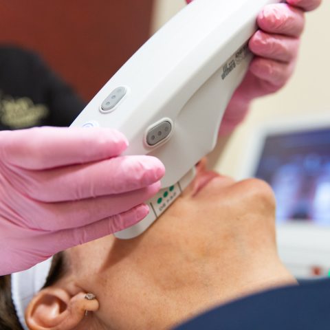 Woman receiving Ultherapy treatment