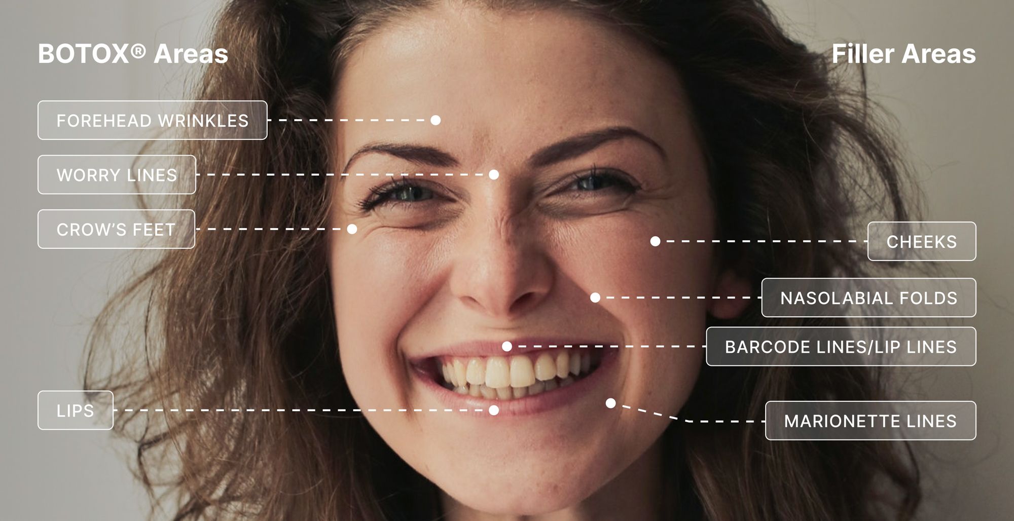 infographic comparing cosmetic injectable use areas