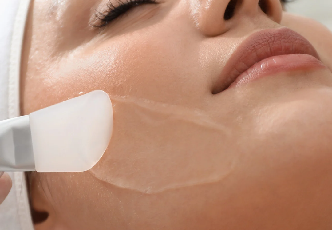 Provider applying a chemical peel solution with a brush to a woman's cheek at Skin Rejuvenation Clinic in Edina